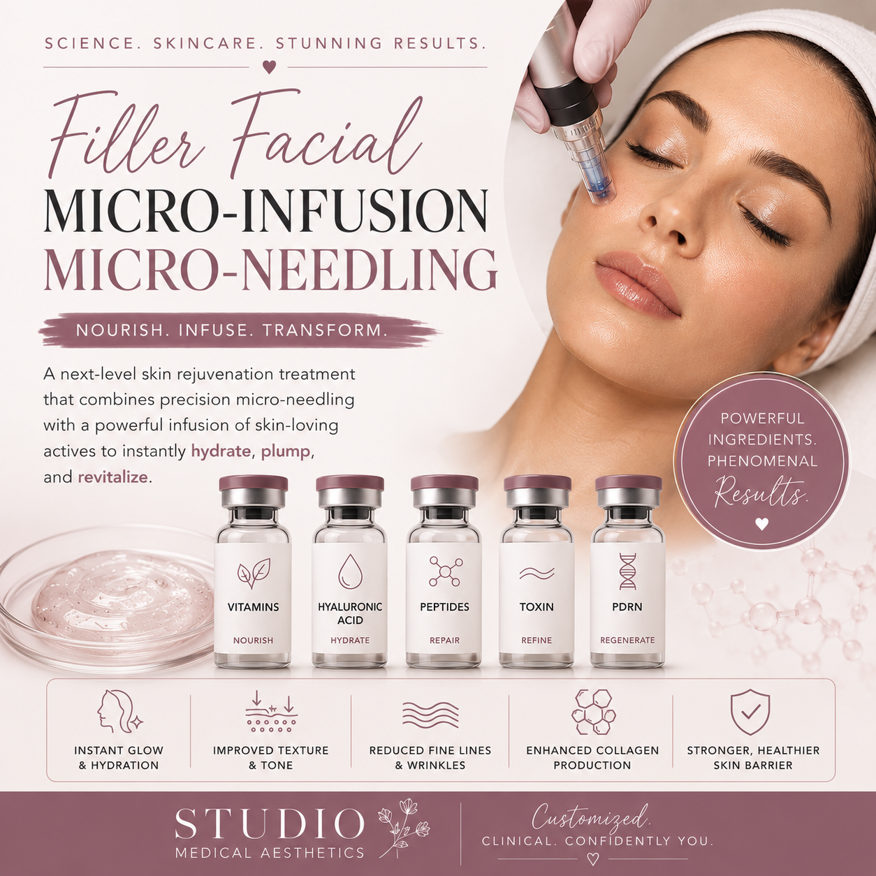 Liquid Gold Micro-infusion Micro-needling- (Filler Facial)