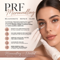 PRF Facial Rejuvenation/Micro-needling Single Treatment